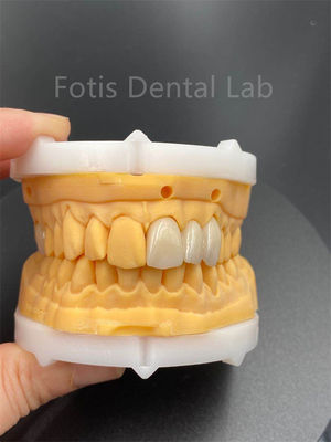 Cerâmica dentária de zircônio multicamadas de alta durabilidade para produtos médicos de laboratório dentário