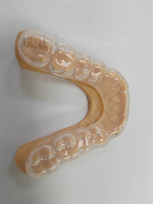 Ergonômico Defensor oclusal duro macio Defensor dentário macio Uso a longo prazo