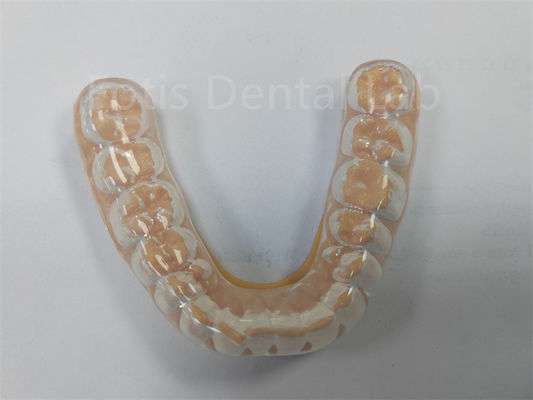 Profissional Hard Soft Night Guard Mantenha os Dentes Saudáveis Proteção Dentária