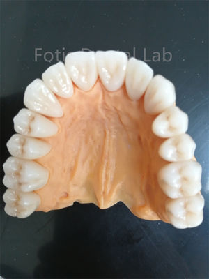 Zirconia avançada de várias camadas para resistência superior ao desgaste e à corrosão