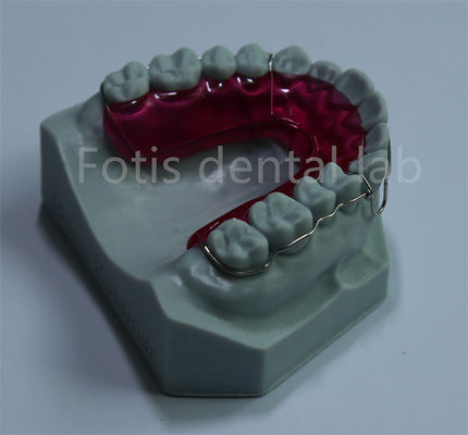 O expansor de retenção ortodôntica é uma solução confortável e acessível