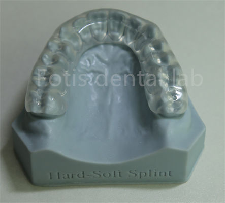 Retentor ortodôntico ajustável e personalizável expansor para retenção e expansão dos dentes