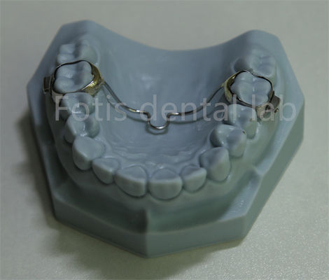Expandor Dental Versátil Retentor Solução Acessível para a Maioria dos Tratamentos Ortodônticos