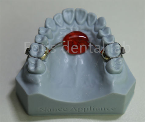 Laboratório Dental Expansor Palatal Ortodôntico Acessível e Compatível com a Maioria dos Tratamentos