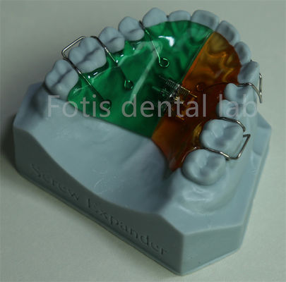 Extensor de retenção ortodôntica versátil e confortável para retenção eficaz dos dentes