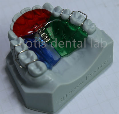 Expansor ortodôntico personalizável e ajustável para retenção eficaz dos dentes