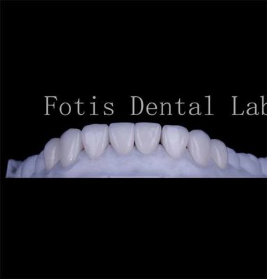 Bom preço. Duração de duração textura suave Dentes cobrir folhas Folhas dentárias naturais on-line