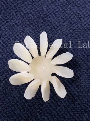 Finete de porcelana dental resistente a manchas Alta resistência para resultados ideais