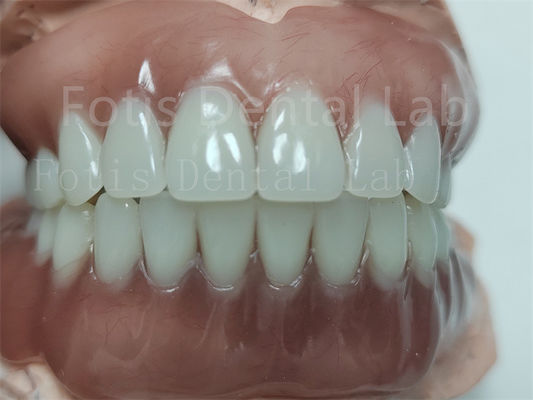 Bom preço. Dentadura de Acrílico Completo Com Dentes Ivoclares on-line