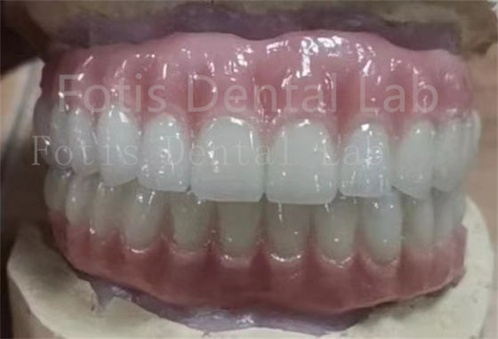 Bom preço. Dentes Ivoclares Précios Dentes Ivoclares Acrílicos Dentes Completos Resistentes a Manchas on-line