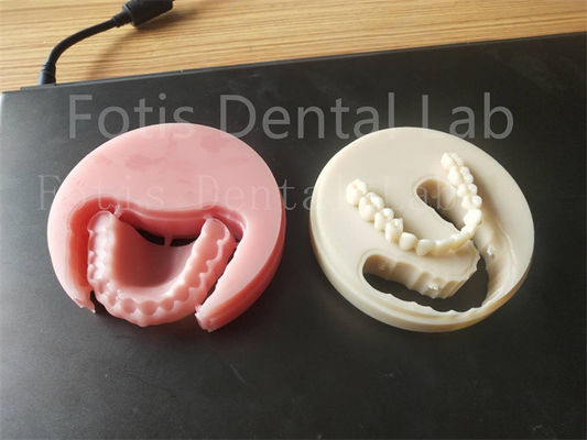 Bom preço. Conforto adequado Prótese dental acrílica completa para técnicos profissionais Fácil de limpar on-line