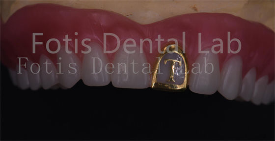 Bom preço. OEM Dentadura natural de acrílico completo Dentes Ivoclar Resistente a manchas on-line