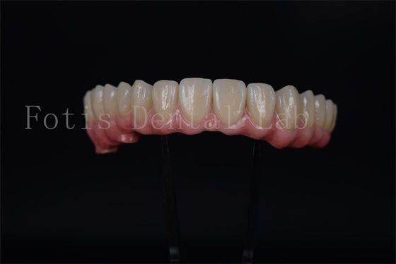Bom preço. Ponte de Implante de Arco Completo Todos em 4 Todos em 6 Para Restauração Dental Completa on-line
