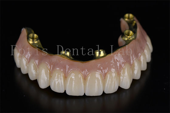 Bom preço. Tratamento Profissional Eficiente Todos em 6 Implantes para Problemas Odontológicos on-line