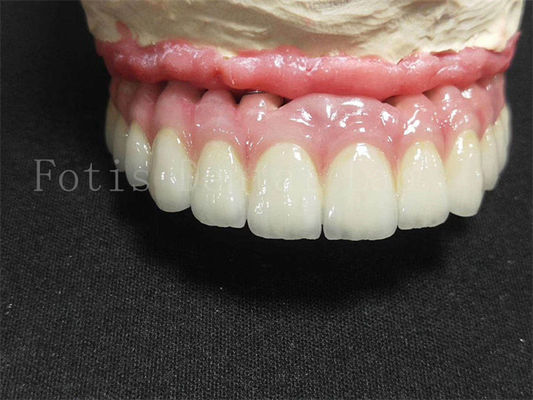 Bom preço. Coroa de Implante de Titânio / Circônio Lustrada Finish Coroa Dental Artificial on-line