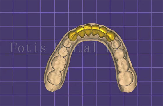 Bom preço. Fabricante de Modelo de Boca Dental Personalizável Autoclavavel FDA aprovado on-line