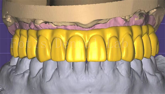 Bom preço. Profissional de 3 formas de design de coroa Excelente desempenho e durabilidade on-line