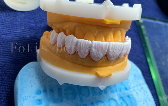 Bom preço. Coroas Dentárias Digitais Avançadas Implante Coroa Dentrue FDA/ISO/CE Certificado on-line