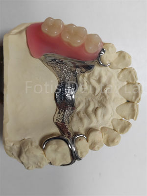 Bom preço. Dentadura parcial removível resistente a odores e altamente ajustável on-line