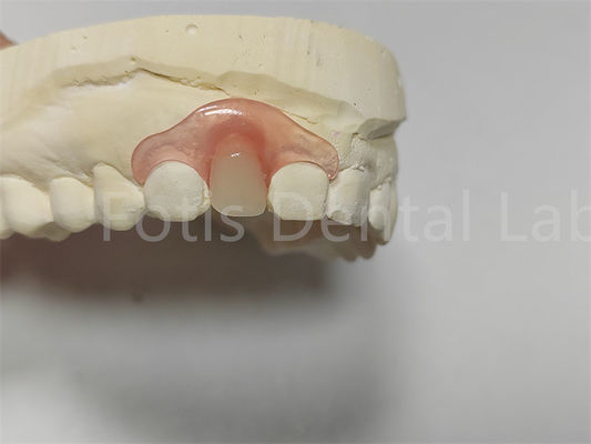 Bom preço. Parciais dentárias flexíveis de Valspar Rosa / Transparente Facil ajuste on-line
