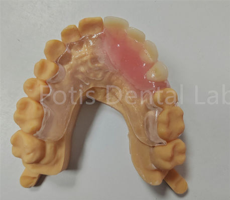 Bom preço. Dispositivo dental TCS parcial de Valplast flexível com conforto hipoalergénico on-line