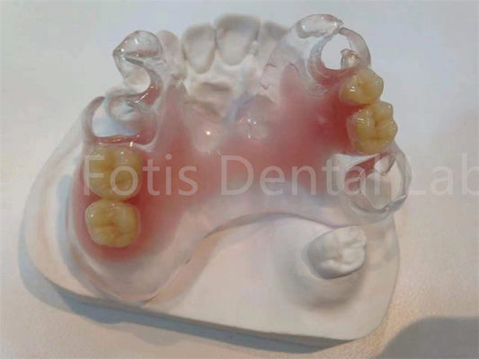 Bom preço. Prótese dentária TCS Valplast Hipoalergénica Resistente a Manchas para conforto duradouro on-line