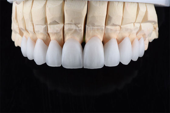 Bom preço. Resistência a rachaduras Zirconia Cerâmica Multicamadas Solução definitiva para eficiência industrial on-line