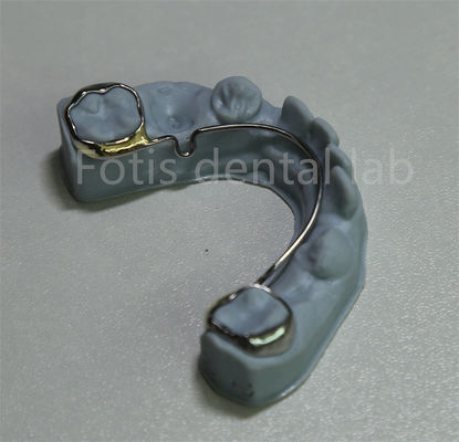 Bom preço. China Laboratório Dental Retentor Ortodôntico Para Dentes de Expansão on-line