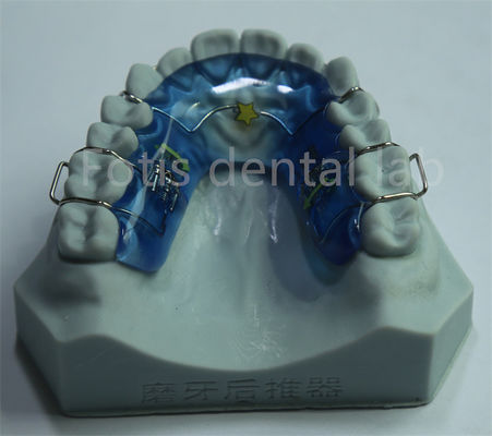 Bom preço. Fácil de limpar e manter Expansor Palatal Ortodôntico Versátil para Dentes Duráveis on-line